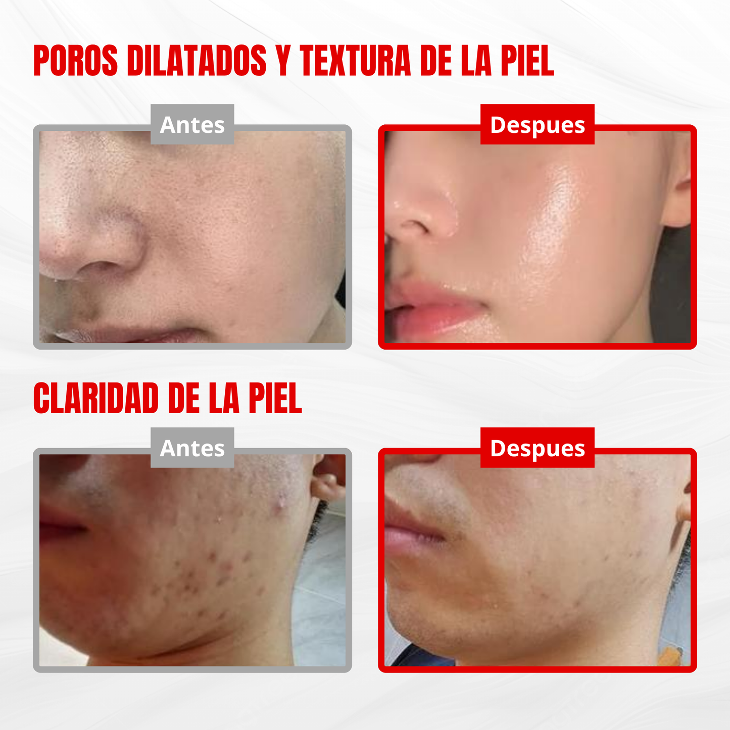 Reedle Shot 300: Micro-agujas de Absorción Profunda para una Piel de Porcelana