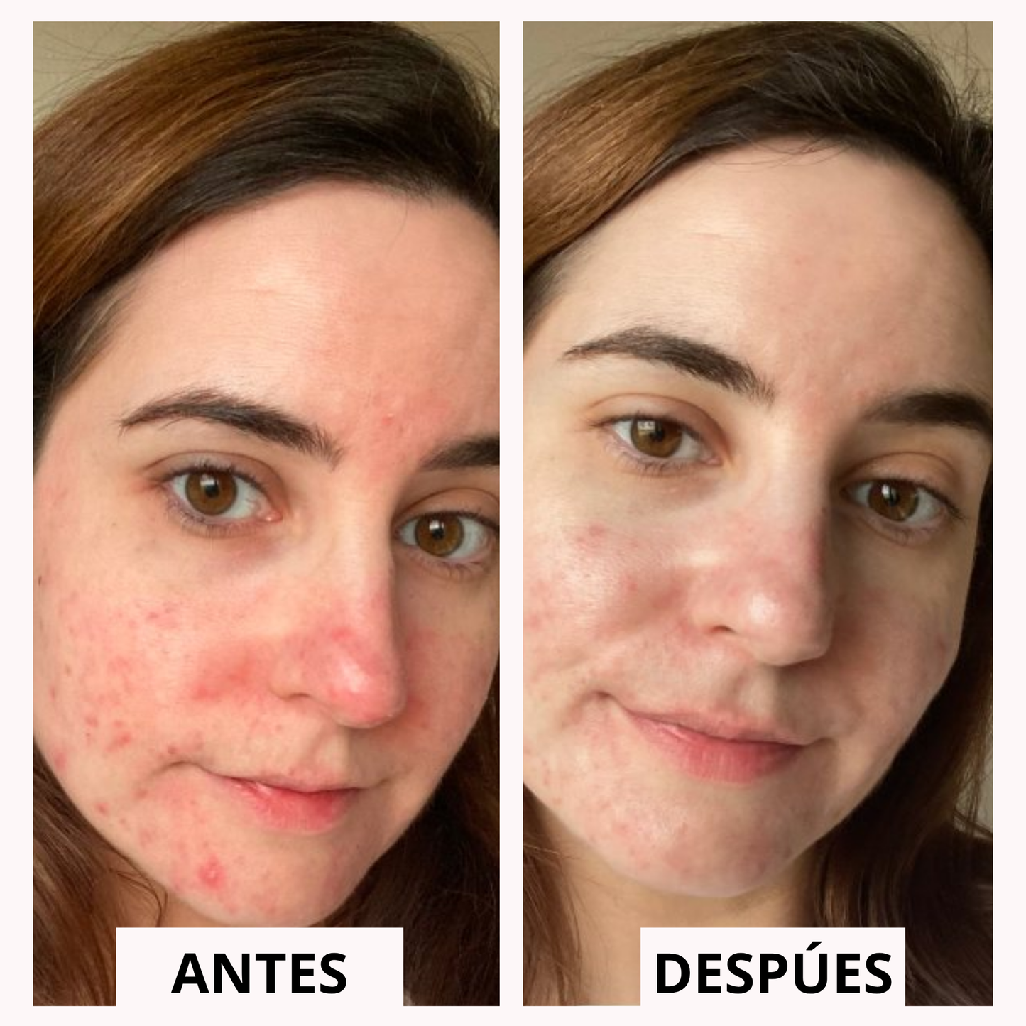 Hydra Renova™ | Piel hidratada y luminosa en segundos