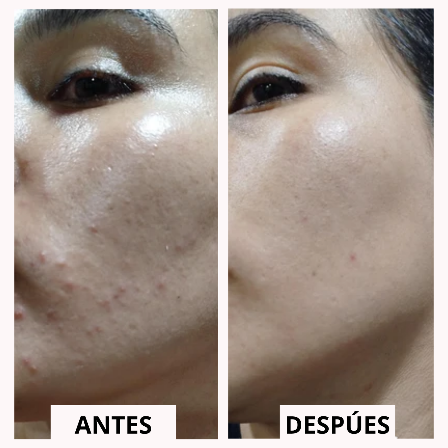 Hydra Renova™ | Piel hidratada y luminosa en segundos