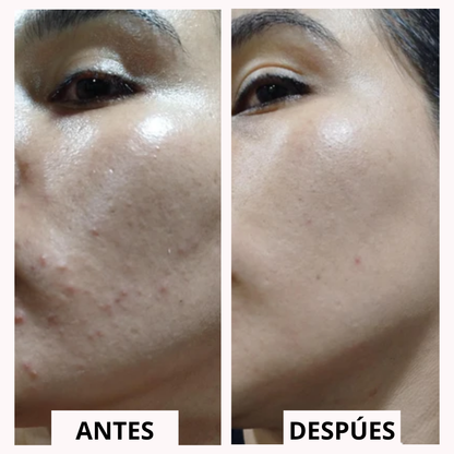 Hydra Renova™ | Piel hidratada y luminosa en segundos