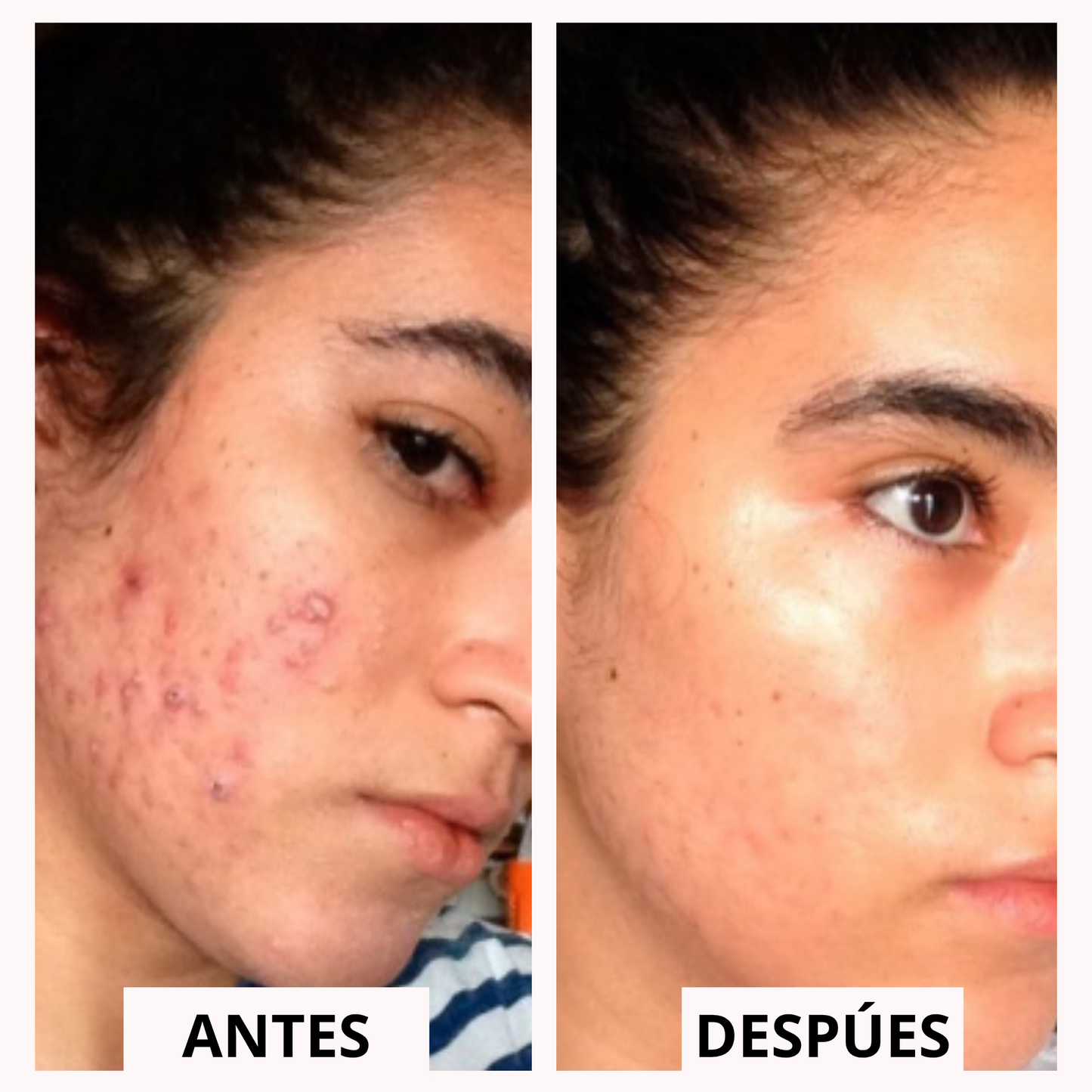 Hydra Renova™ | Piel hidratada y luminosa en segundos